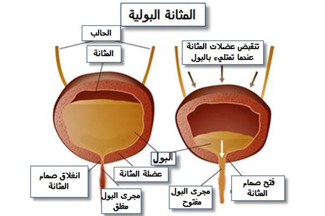 أسباب احتباس البول عند الأطفال