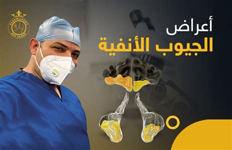 أعراض التهاب الجيوب الأنفية والصداع