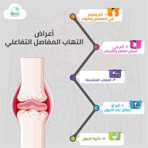 أعراض التهاب المفاصل