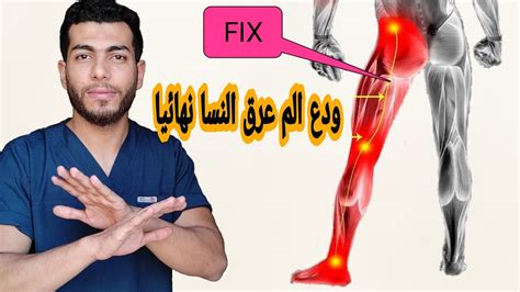 أعراض عرق النسا