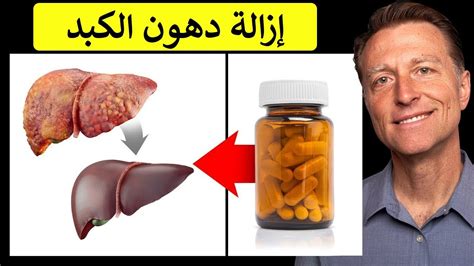 أفضل الفيتامينات لعلاج الكبد الدهني