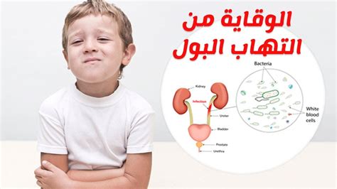 طرق الوقاية من احتباس البول عند الأطفال