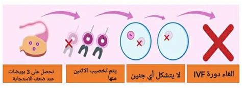 قلة استجابة المبيض بعد التطعيم