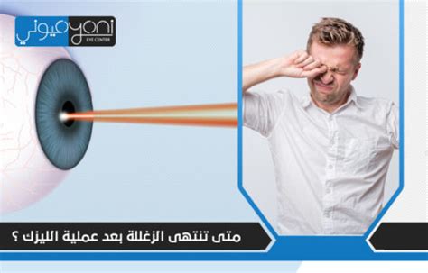 متى تنتهي مشاكل جفاف العين بعد الليزك؟