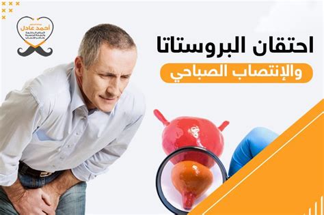 مضاعفات احتقان البروستاتا المزمن