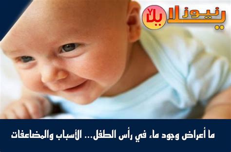 أعراض وجود الماء في الرأس: