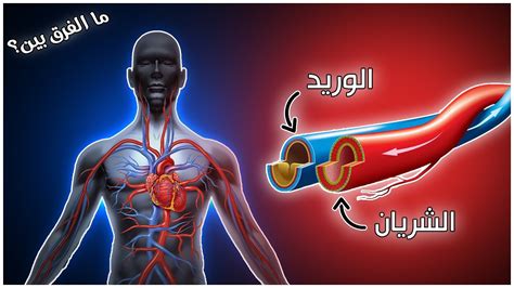 الفرق بين الحقن الوريدي والحقن الشرياني