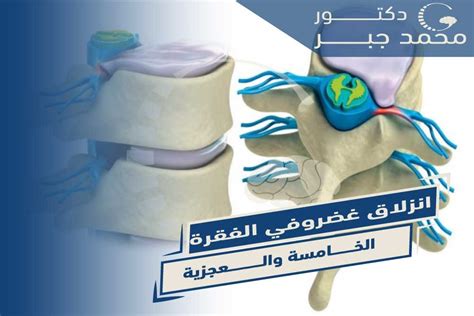 الفقرة 5: الاستنتاج والادعاء