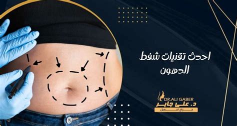 جدة تقنية شفط الدهون المتاحة