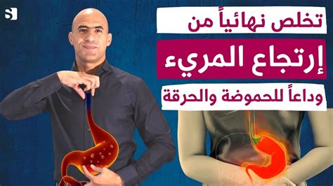 علاج حرقة المعدة: