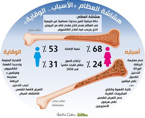 فقرة نصية عن هشاشة العظام